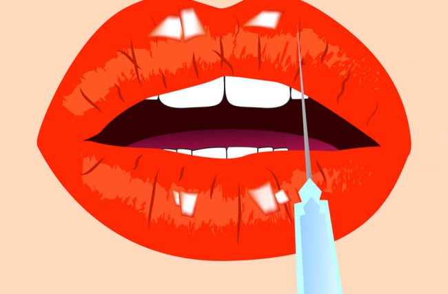 9 mitos e verdades sobre o uso do botox na odontologia