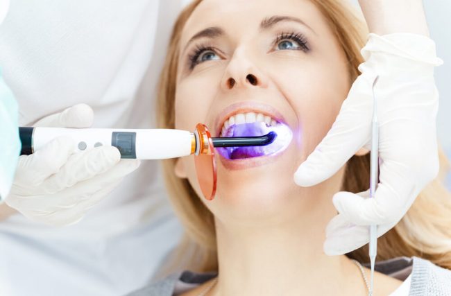 Clareamento dental: tudo o que você precisa saber sobre o assunto