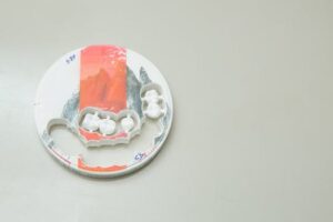 Quantos dias de repouso são necessários após uma cirurgia de implante dentário?