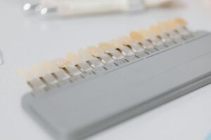 O que é Odontologia Estética?